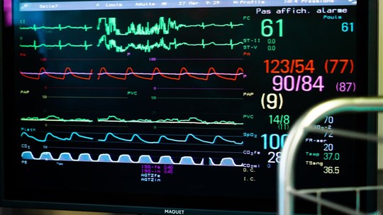 Fibrillation auriculaire: utilité douteuse des anticoagulants pour certains patients